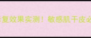 Laletoya面膜补水修复效果实测敏感肌干皮必看成分与使用指南