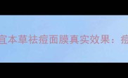 权威测评相宜本草祛痘面膜真实效果痘痘肌必看