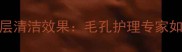 七彩火山泥面膜深层清洁效果毛孔护理专家如何解决肌肤问题